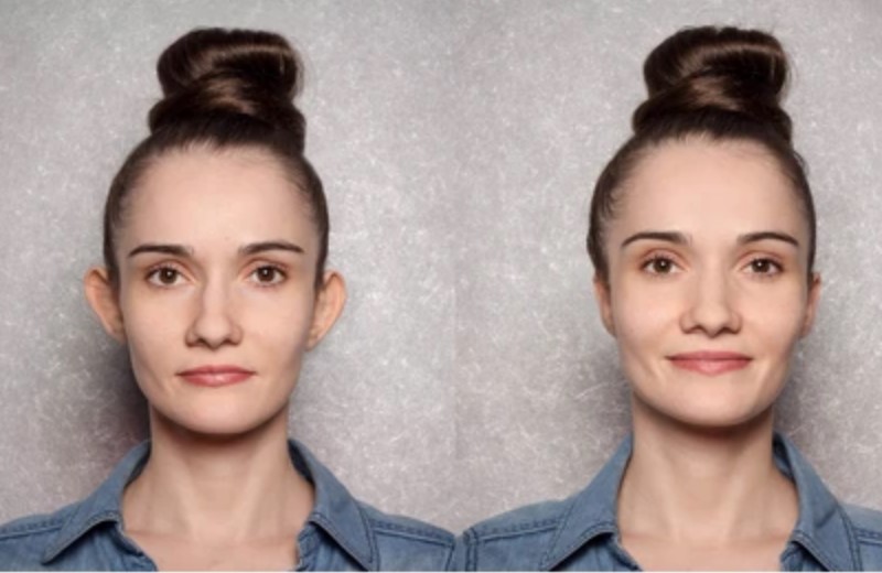 Za korekcijo ušes se lahko odločijo ljudje, ki imajo štrleča ušesa, ki se pojavljajo na eni ali obeh straneh v različni meri.